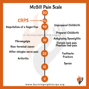 McGill pain scale from 0 to 50 placing CRPS at 42, above amputation of a finger or toe and unprepared childbirth, and well above fibromyalgia, chronic back pain, arthritis and fractures